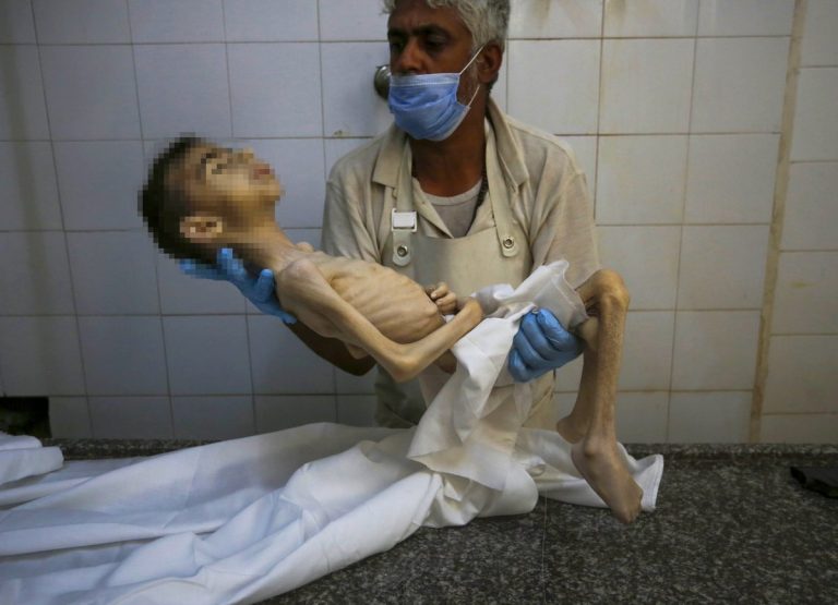 anak kelaparan gaza